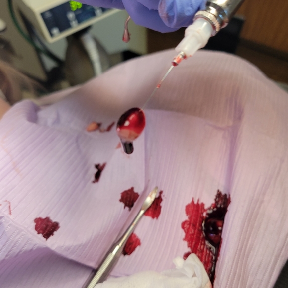 ⚠️Med.Photos ⚠️Warning - Picture 8 of 9